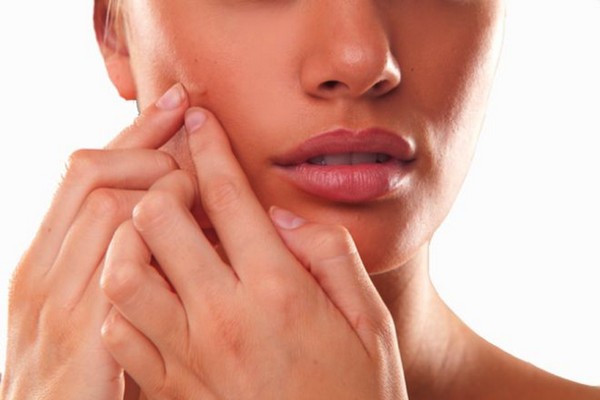 Adult Hormonal Acne: Causes and Treatment